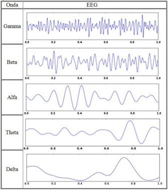 Gráfico donde se representan los distintos tipos de ondas cerebrales, ordenadas de menor frecuencia (arriba) a mayor frecuencia (abajo).